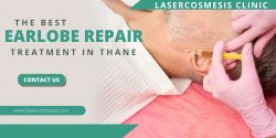 Earlobe Repair Treatment in Thane