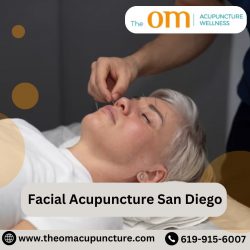 Facial Acupuncture San Diego