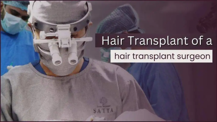Dr Shaiil Gupta’s own hair transplant