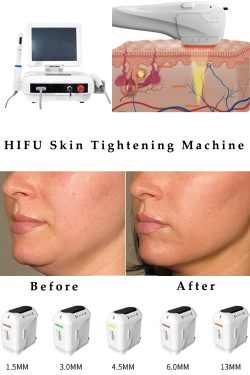 HIFU machine for body and face professiona. High intensity focused ultrasound HIFU machine. FDA  ...