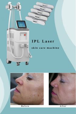 The best IPL laser machine professional. IPL laser skin care machine. IPL laser machine manufact ...