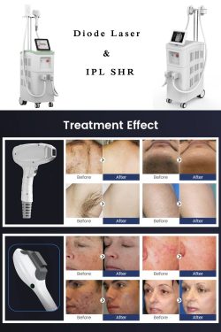 Diode laser hair removal machine & IPL SHR laser machine supplier-BVLASER. The best laser ha ...