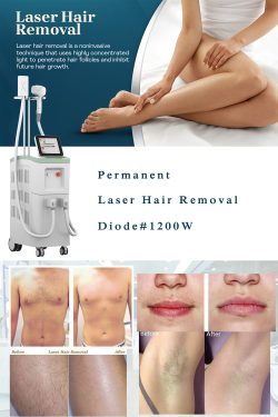 China big spot size diode laser hair removal machine-BVLASER. High power diode laser hair remova ...
