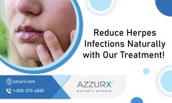 Get Trusted Natural Herpes Treatment Today!
