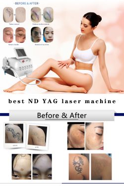 Wholesale ND YAG laser tattoo removal machine. ND YAG laser dermatology. China Q-switched ND YAG ...