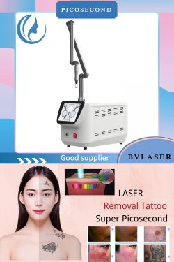 OEM picosecond laser portable. Professional picosecond laser tattoo removal machine manufacturer ...