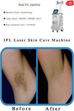 The best IPL laser machine-BVLASER. IPL laser skin care machine. Professional IPL permanent lase ...