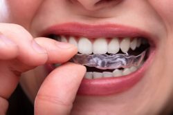 What Causes Teeth Grinding and How to Protect Your Smile from Bruxism