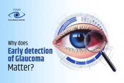 Preserving Sight: The Vital Role of Early Glaucoma Detection at One of the Best Eye Hospitals