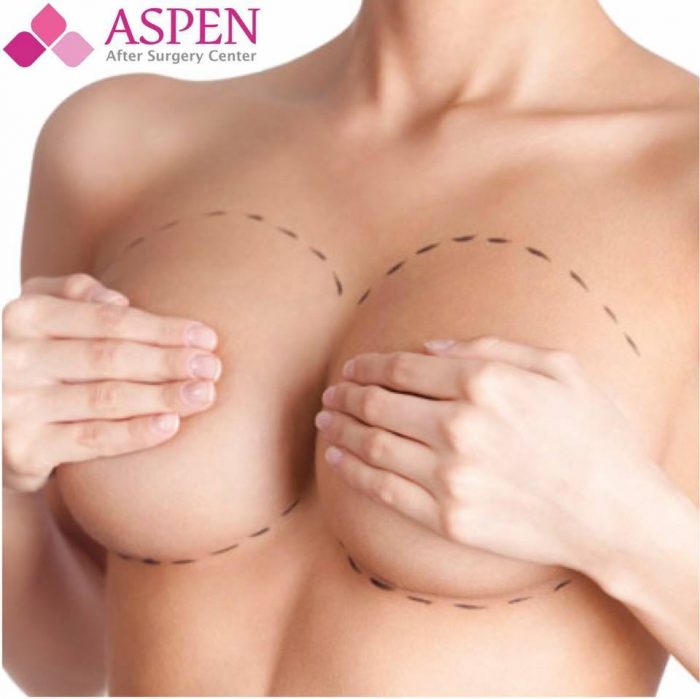 Breast Implant Augmentation Complications