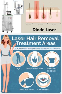 1200W diode laser hair removal machine. Professional laser hair removal machine commercial. The  ...