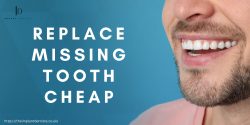 Exploring Cost-Effective Solutions, with The Implant Dentists in Crewe