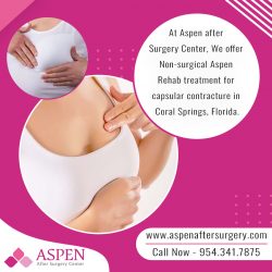 Capsular Contracture Treatment in Coral Springs Florida