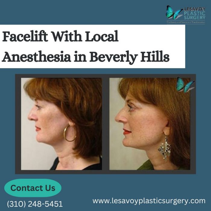 Facelift With Local Anesthesia in Beverly Hills Social Social Social