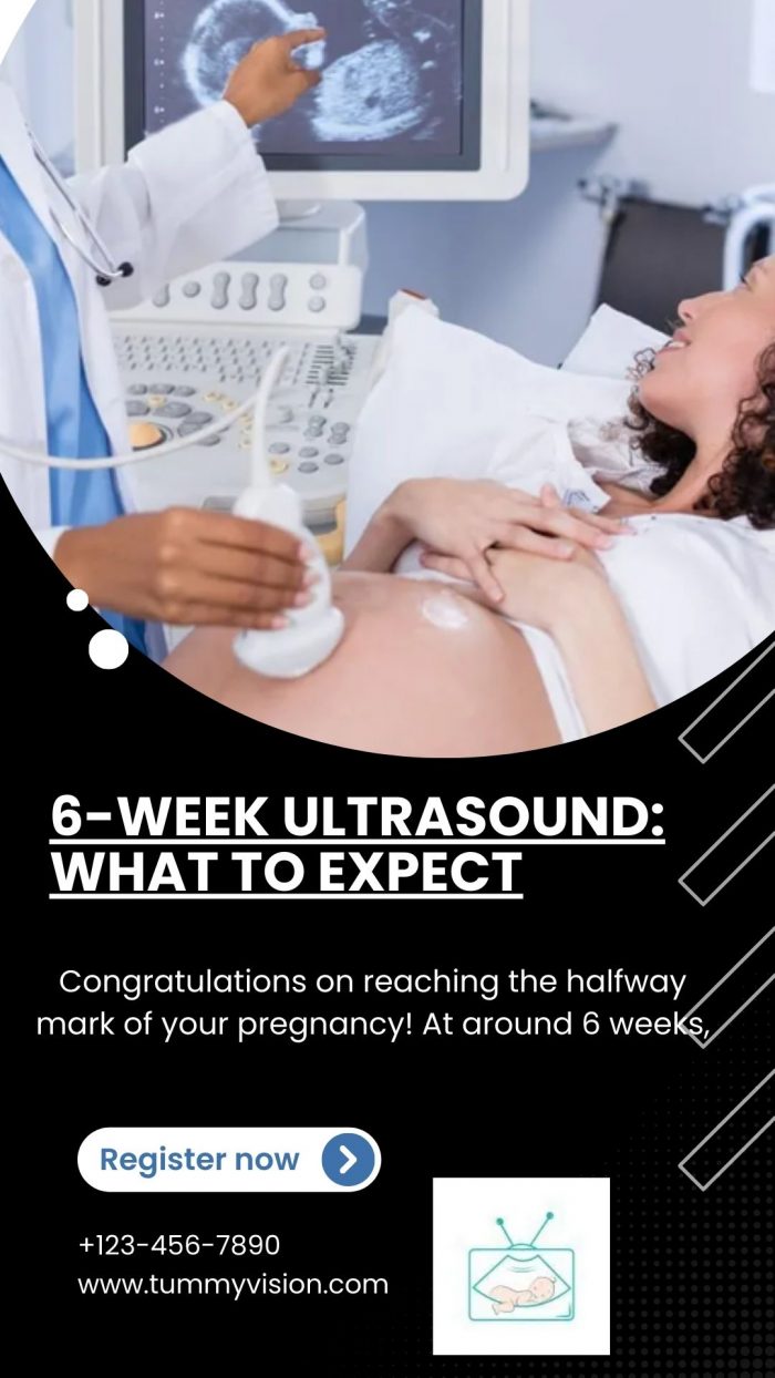 6 Week ultrasound pictures