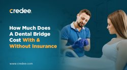 How Much Does A Dental Bridge Cost With & Without Insurance