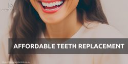 Experience the Future of Affordable Tooth Replacement with Our Implant Technology, UK