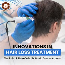 Innovations in Hair Loss Treatment: The Role of Stem Cells | Dr David Greene Arizona