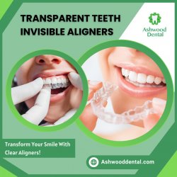 Invisible Teeth Alignment Solution