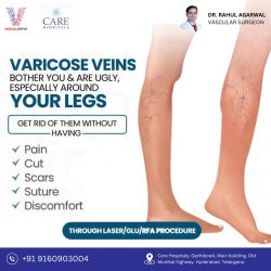 Leg Pain Specialist Doctor in Hyderabad | Vascularhyd