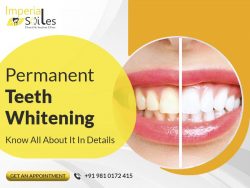 Illuminate Your Smile Permanently: Unveiling the Magic of Permanent Teeth Whitening!
