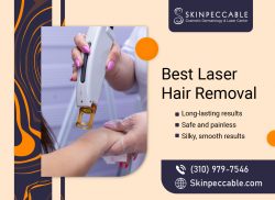 Professional Hair Removal Service