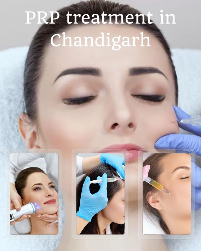Esthetica Cosmetology: Leading the Way with Best PRP Treatment in Chandigarh