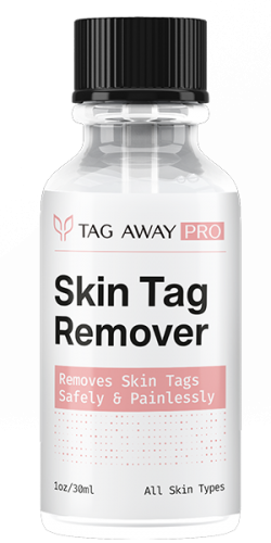 Tag Away Pro Skin Tag Remover (2024 Live SALE!!) Serum To Remove Moles, Skin Tags Anywhere From Body