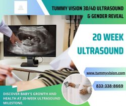 A Miraculous Glimpse: Celebrating the 20-Week Ultrasound Moment