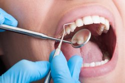 Experience Excellence: Best Root Canal Treatment Near Chandigarh at Esthetica Dental Clinic Mohali