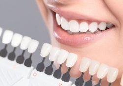 When Is Teeth Whitening Appropriate? Considering Factors for a Brighter Smile