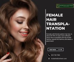 Female Hair Transplantation