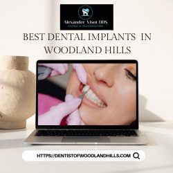 Best Dental implants in Woodland Hills