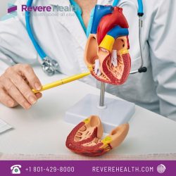 Trusted Cardiologist Treatment in Utah | Revere Health