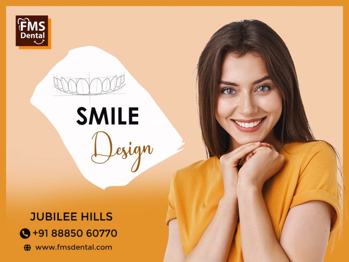 Get Stunning Smile With Smile Design Done By FMS Dental