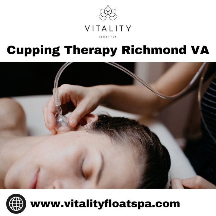 Cupping Therapy Richmond VA