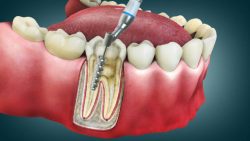 Top Dental Care in Woodbridge, VA: Find the Best Dentist!