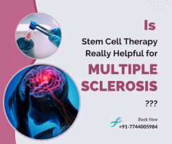 Is Stem Cell Therapy Really Helpful for Multiple Sclerosis