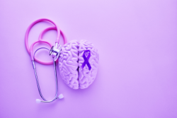 Surprising Facts about Alzheimer’s Disease