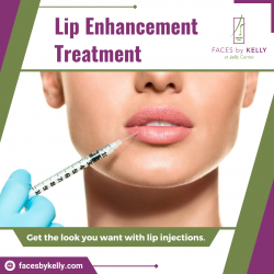 Lip Injections to Enhance Your Beauty