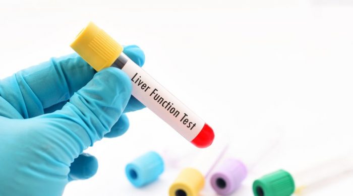Book Your Liver Function Test Now