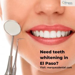 Need teeth whitening in El Paso?