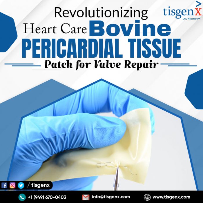 Revolutionizing Heart Care Bovine Pericardial Tissue Patch for Valve Repair