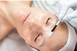 How Acne Scar Facials Win the Battle for Smooth Skin- Vivid Skin, Hair & Laser Center