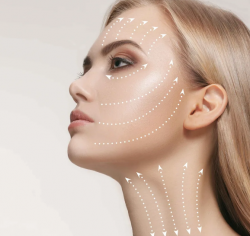 What are the Advantages of a Thread Lift- Vivid Skin, Hair & Laser Center