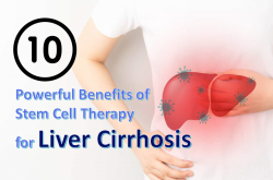 10 Powerful Benefits of Stem Cell Therapy for Liver Cirrhosis