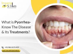 Pyorrhea Treatment Cost | Imperial Smiles