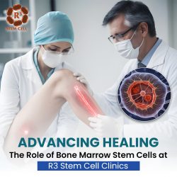 Advancing Healing: The Role of Bone Marrow Stem Cells at R3 Stem Cell Clinics