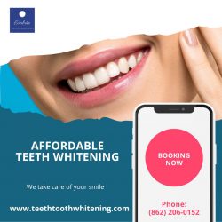 Affordable Teeth Whitening Service – Everbrite Teeth Whitening