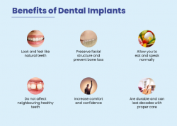 Stronger Bite, Brighter Future: The Advantages of Dental Implants